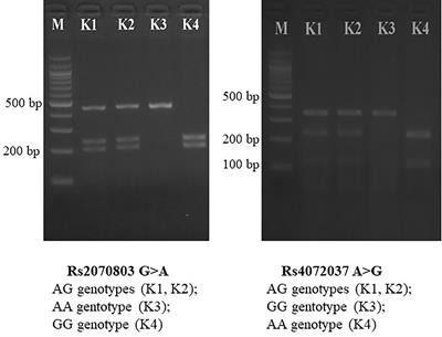 Polymorphism of MUC1 Gene in Vietnamese Gastric Cancer Patients: A Multicenter Case–Control Study